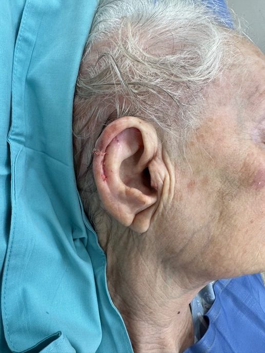 מיד לאחר השחזור